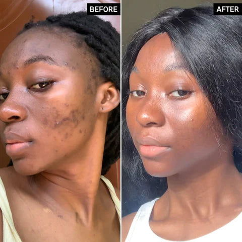 🌿 Turmeric Kojic & Arbutin Glowing Cream 🌞