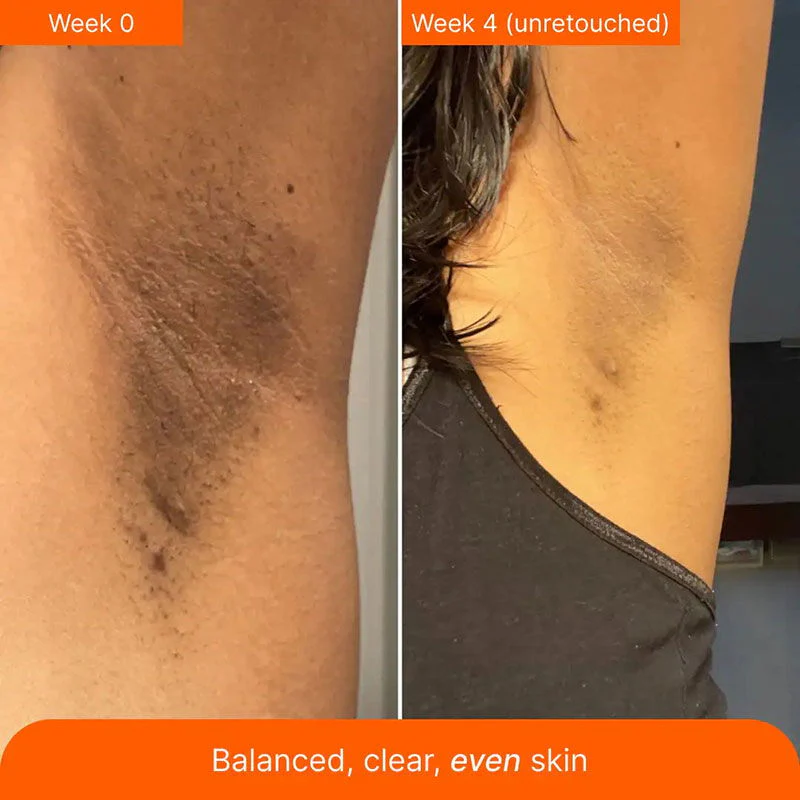 🌿 Turmeric Kojic & Arbutin Glowing Cream 🌞