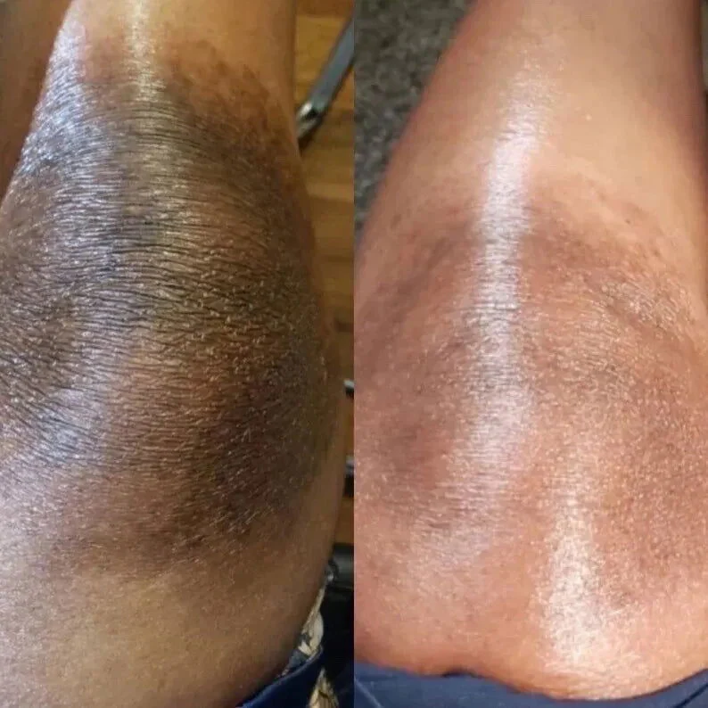 🌿 Turmeric Kojic & Arbutin Glowing Cream 🌞