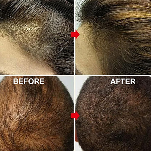 🪔 Pure Batana Hair Growth Serum – Dr. Sebi Approved 🌱