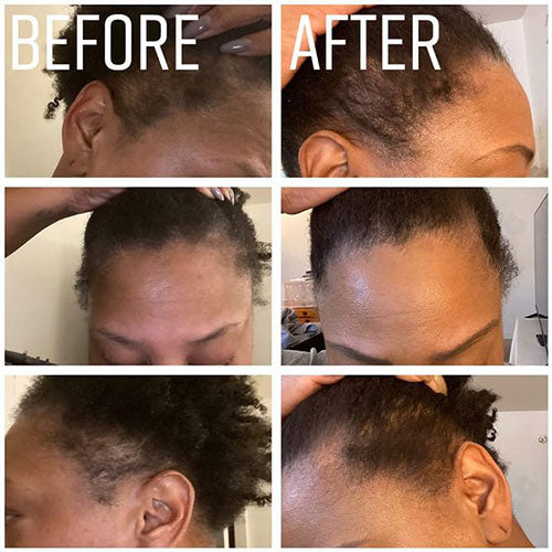 🪔 Pure Batana Hair Growth Serum – Dr. Sebi Approved 🌱