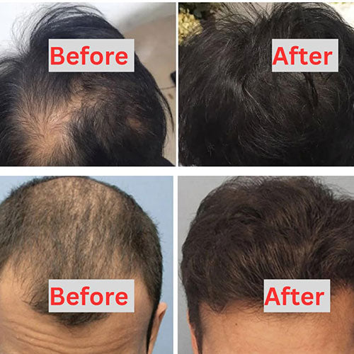🪔 Pure Batana Hair Growth Serum – Dr. Sebi Approved 🌱