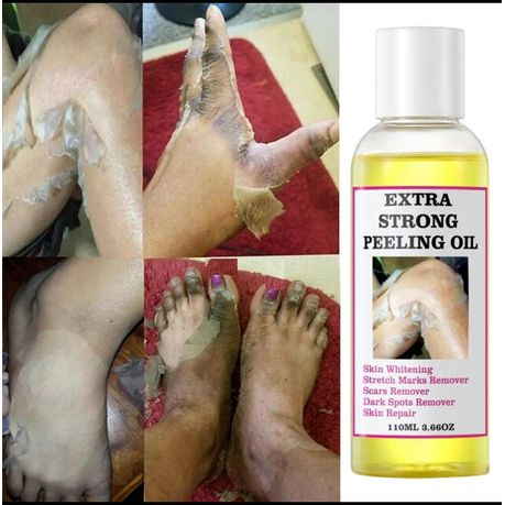 💛 Extra Strong Yellow Peeling Brightening Oil Serum ✨