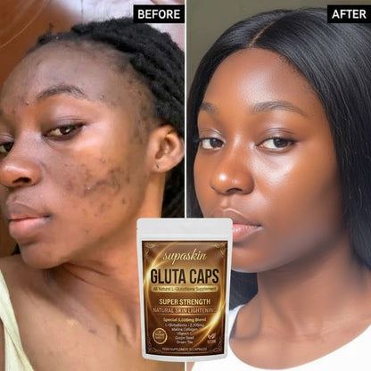 Supaskin Glutathione 5000mg Skin Lightening & Anti-Ageing Caps