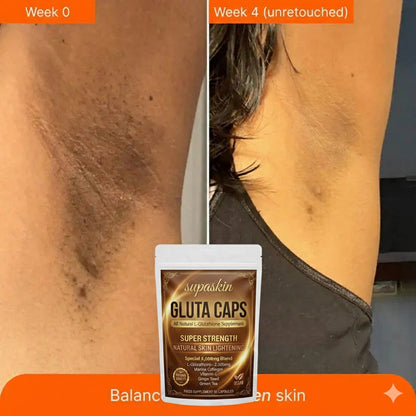 Supaskin Glutathione 5000mg Skin Lightening & Anti-Ageing Caps