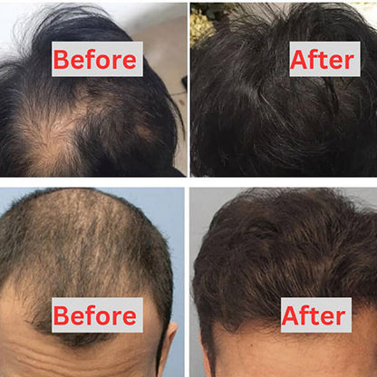🪔 Pure Batana Hair Growth Serum – Dr. Sebi Approved 🌱