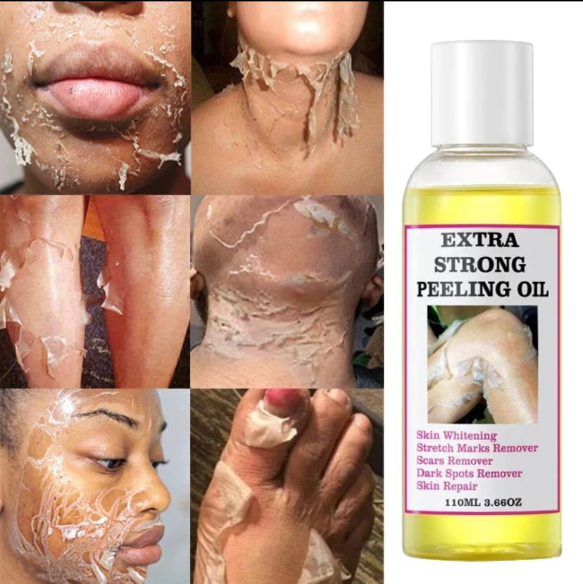 💛 Extra Strong Yellow Peeling Brightening Oil Serum ✨