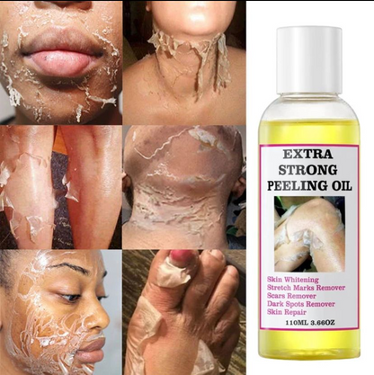 💛 Extra Strong Yellow Peeling Brightening Oil Serum ✨